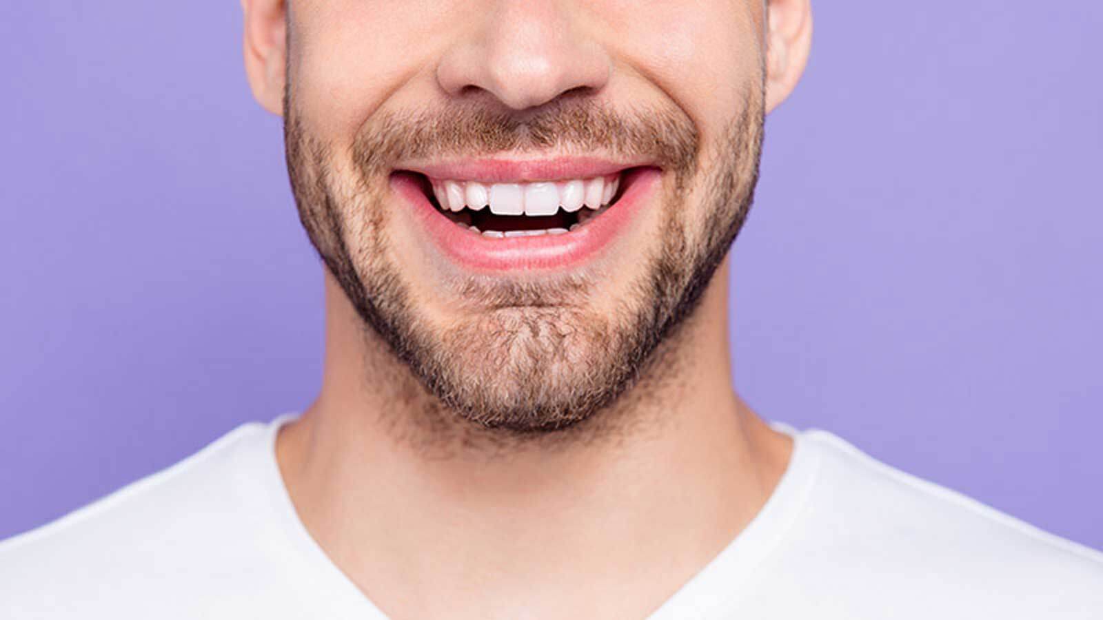   Smile Makeover: Dental Treatment